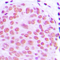 c-Jun Antibody [KO/KD Validate