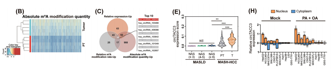 核内副斑点-环状RNA TACC3组装体通过形成RNA-DNA杂交体，以m6A依赖性方式促进MASH相关肝细胞癌的生长