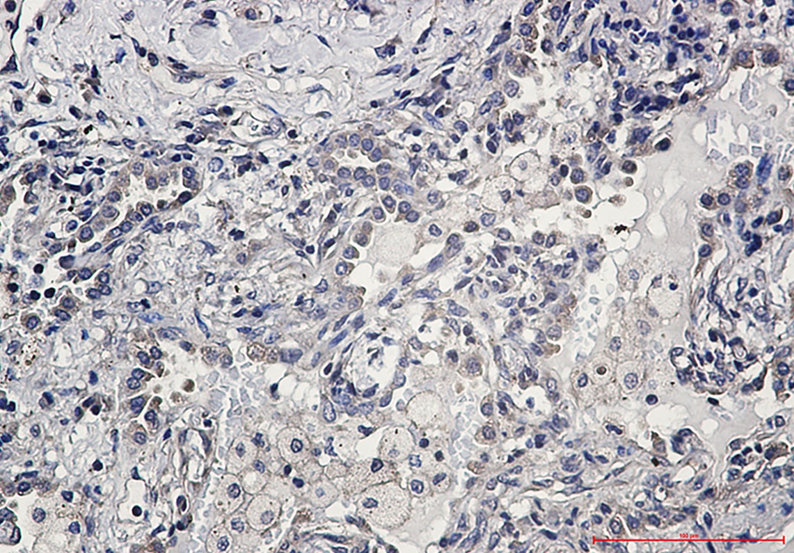 AKT Rabbit mAb抗体，orb1563078，bi