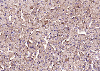 SCARB1/Scavenger Receptor BI R