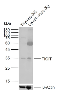 TIGIT Rabbit Polyclonal Antibo