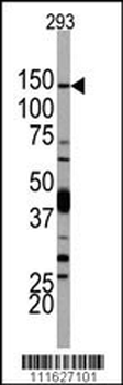 PI3KCD Antibody (N-term)抗体，orb