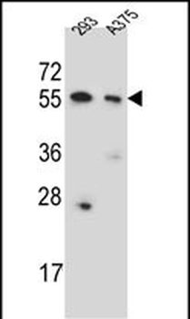 CPNE8 Antibody (N-term)抗体，orb3