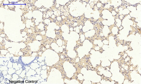 HIF1 alpha Rabbit pAb抗体，orb156