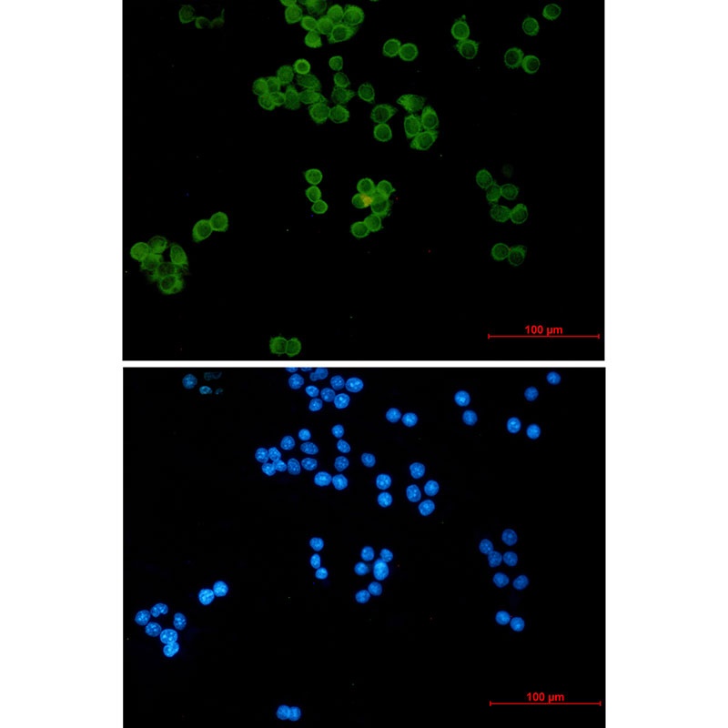 Ubiquitin Conjugating Enzyme E