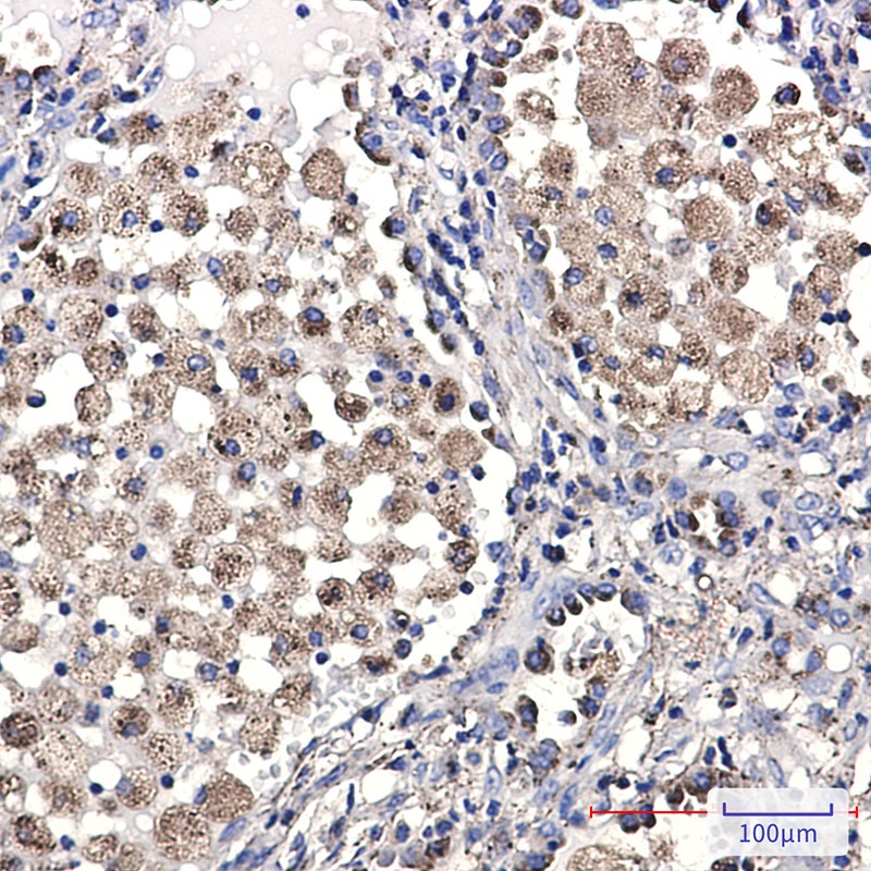 LAMP2 Rabbit mAb抗体，orb1563778，