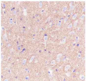 PRNP Recombinant Rabbit Monocl