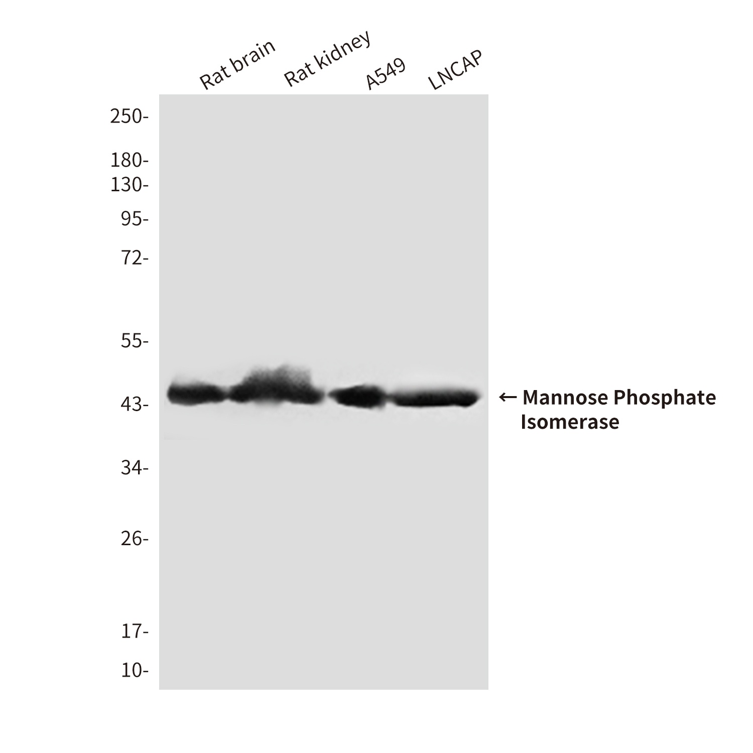 Mannose Phosphate Isomerase (4