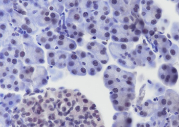 BMAL1 Recombinant Rabbit Monoc