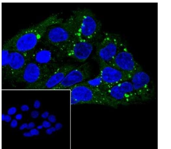 SCARB1/Scavenger Receptor BI R