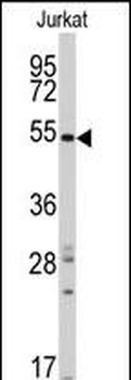 SMYD5 (RAI15) Antibody (C-term