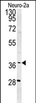 SNRNP40 Antibody (Center)抗体，or