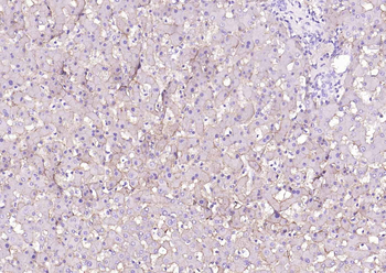 SCARB1/Scavenger Receptor BI R