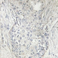 Cytochrome P450 1A2 Antibody抗体