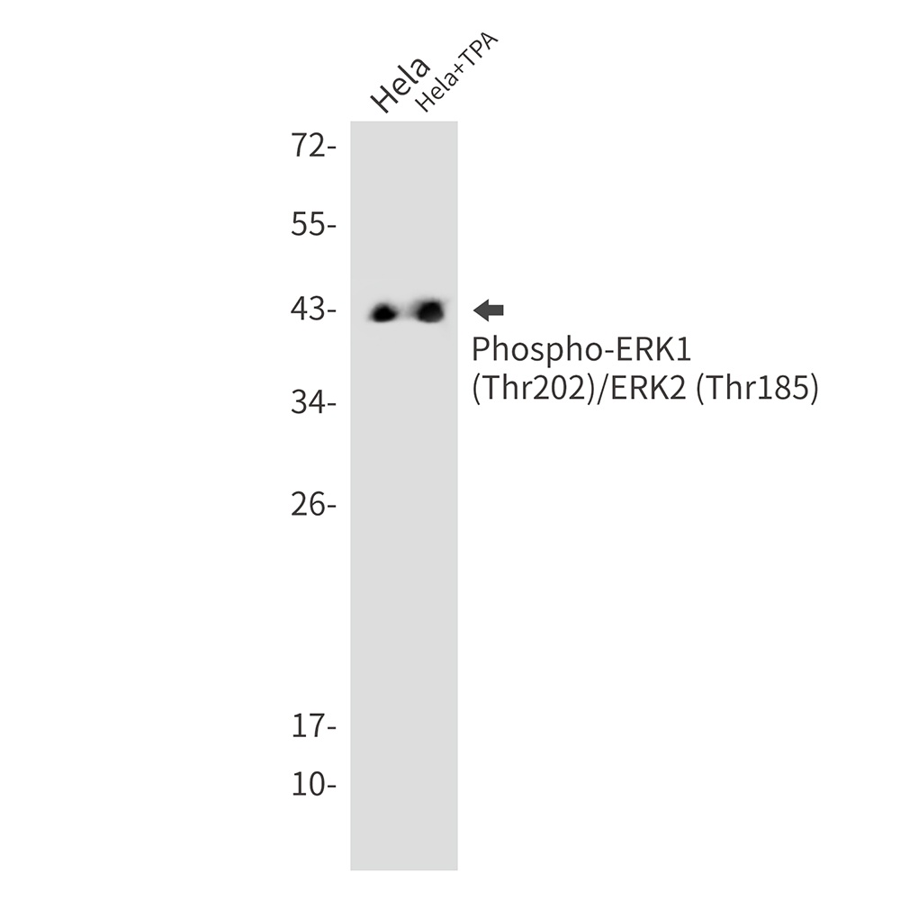 Phospho-ERK1/2 (Thr202/Thr185)