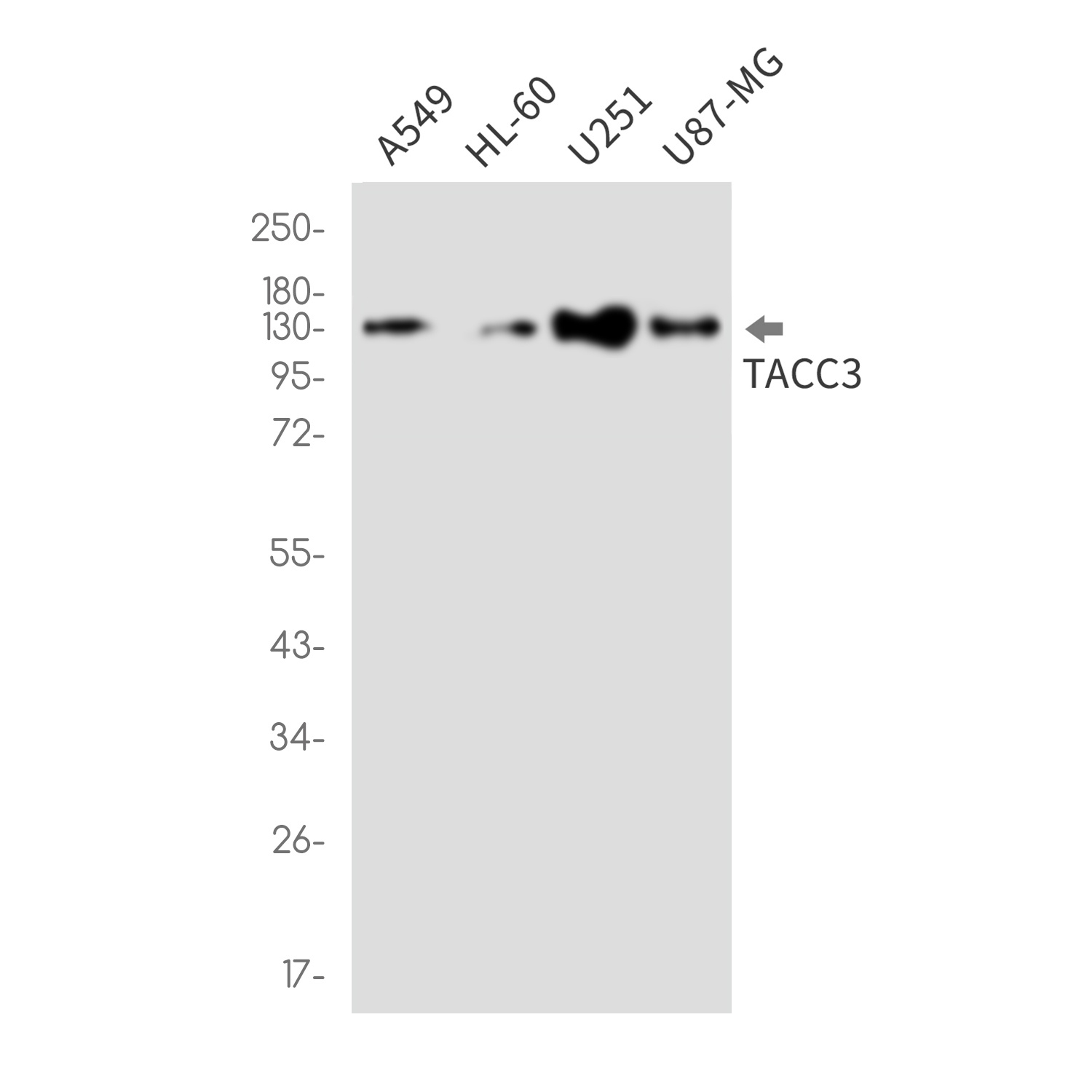 TACC3 Rabbit mAb抗体，orb1563615，