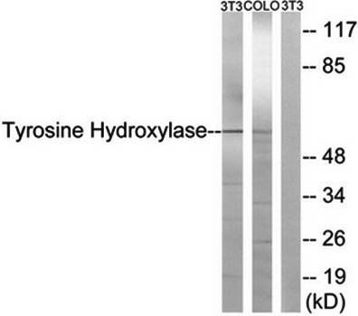 Tyrosine Hydroxylase (Ab-19) A