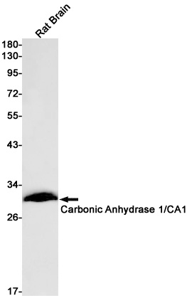 Carbonic Anhydrase 1 Rabbit mA
