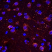 CHAT Antibody抗体，orb1474634，bio