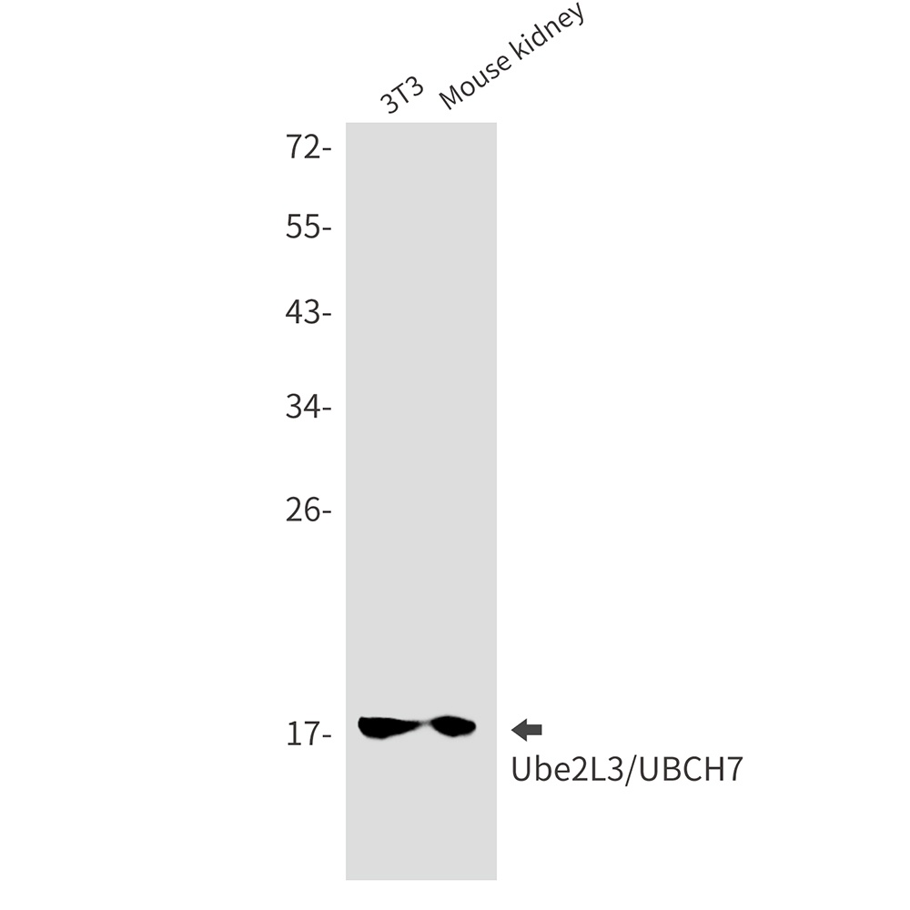 Ubiquitin Conjugating Enzyme E