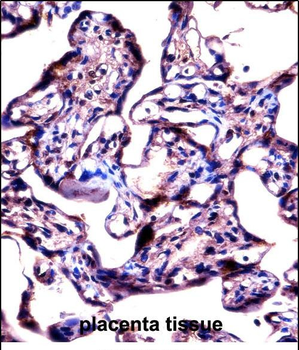 STS Antibody (C-term)抗体，orb327