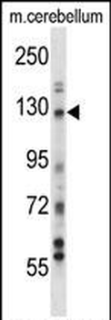 USP15 Antibody (N-term)抗体，orb3