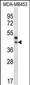 PPT2 Antibody (Center)抗体，orb32