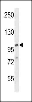 AP2A1 Antibody (C-term)抗体，orb3