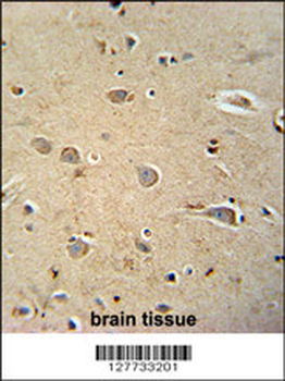 PQLC1 Antibody (Center)抗体，orb2