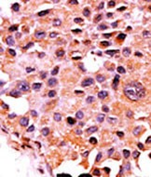 Calcineurin (PPP3CA) Antibody 