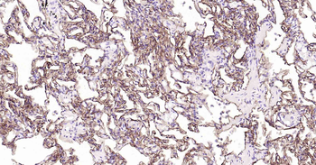 Podoplanin Recombinant Rabbit 
