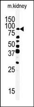 RIPK4 (ANKRD3) Antibody (C-ter