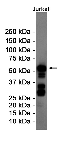[KD] Cyclin B1 Rabbit mAb抗体，or