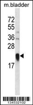 LY86 Antibody (C-term)抗体，orb14