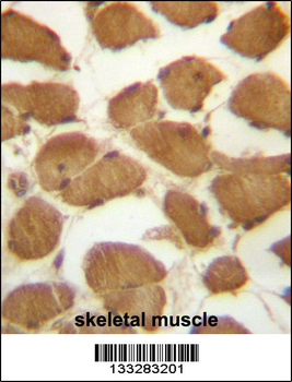 CDKN1B Antibody (C-term)抗体,orb