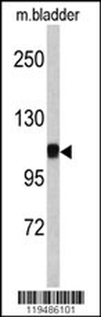 CTNA1 Antibody (N-term)抗体，orb1