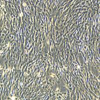 浙江美森-人原代主动脉平滑肌细胞