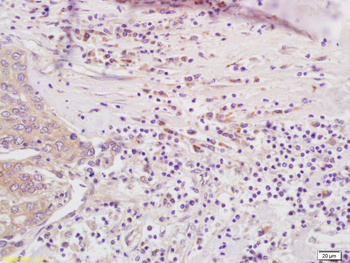 PSMB8 Rabbit Polyclonal Antibo