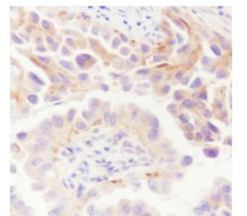 ATG9A Recombinant Rabbit Monoc