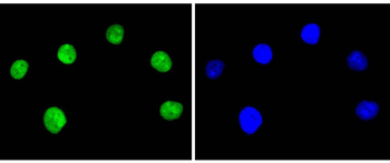 Ku80 Recombinant Rabbit Monocl