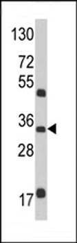 M6PR Antibody (N-term)抗体，orb34