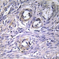 ABHD12 Antibody抗体，orb1474703，b