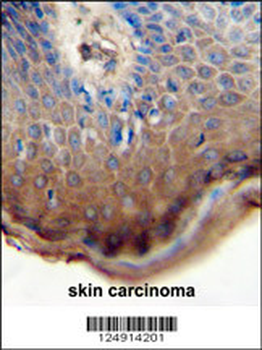 TJAP1 Antibody (N-term)抗体,orb2