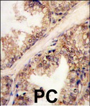 PRMT4 Antibody (C-term)抗体,orb6