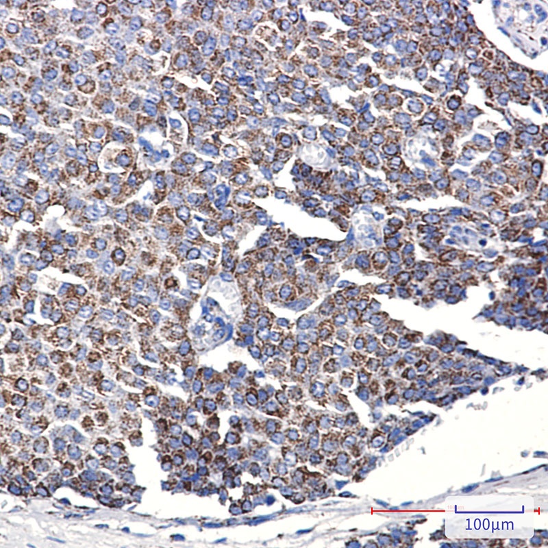 TOMM20 Rabbit mAb抗体，orb1563033