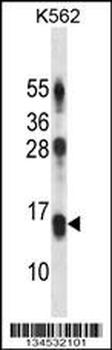 LY86 Antibody (C-term)抗体，orb14