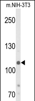 JMJD2B Antibody (T305)抗体,orb14
