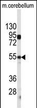 CPE Antibody (C-term)抗体，orb383
