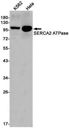 SERCA2 ATPase Rabbit mAb抗体,orb