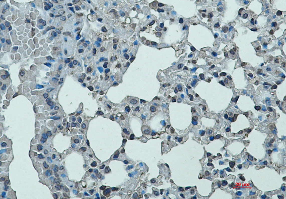 Integrin alpha L Rabbit mAb抗体，